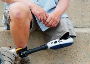 Inovacao no Distrito Federal com Uso de Insulina Analogica de Acao Prolongada