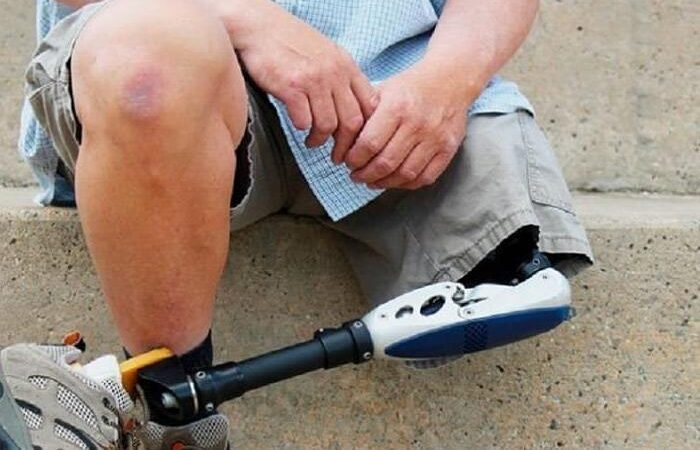 Inovacao no Distrito Federal com Uso de Insulina Analogica de Acao Prolongada