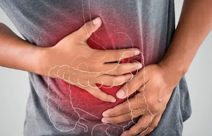 Cancer de intestine e o terceiro tipo mais frequente no Distrito Federal