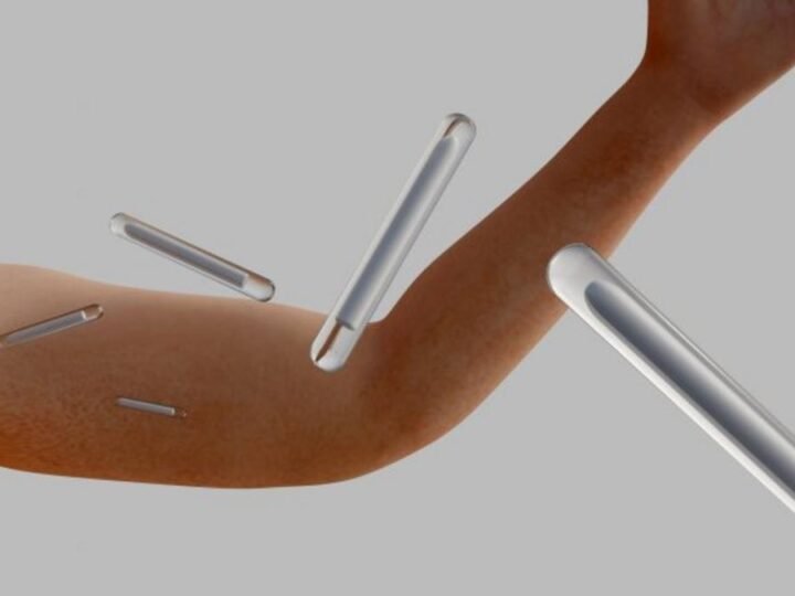 Projeto de Lei 3065/26 proíbe uso de implantes hormonais para estética e ganho muscular