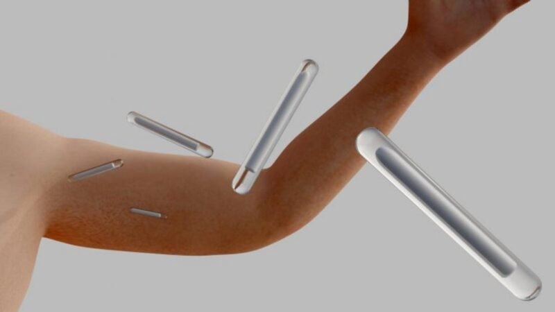 Projeto de Lei 3065/26 proíbe uso de implantes hormonais para estética e ganho muscular